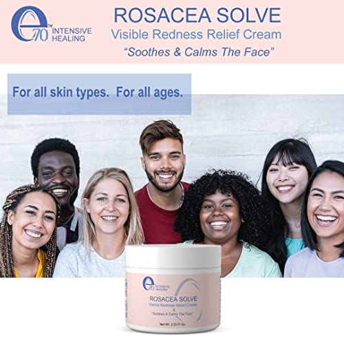 E70 Rosacea Solve - Creme de alívio da vermelhidão - Hidratante de rosto calmante para rosácea e cuidados