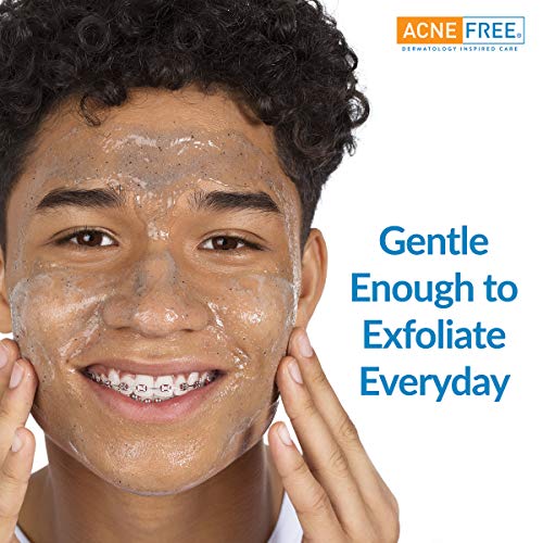 A acne livre de cravo, removendo esfoliação de face com 2% de ácido salicílico e jojoba a carvão,