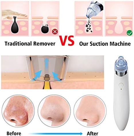 Guangming - Tiras de vácuo de removedor de cravo de cravo descaspam o nariz e o queixo, o dispositivo